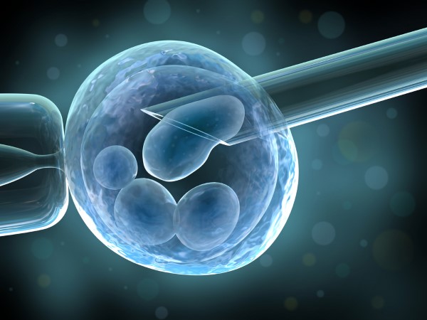 don d'ovules à l'étranger Europe 